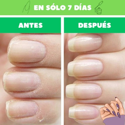 💖BASE MILAGROSA UÑAS DE TITANIOX3💖