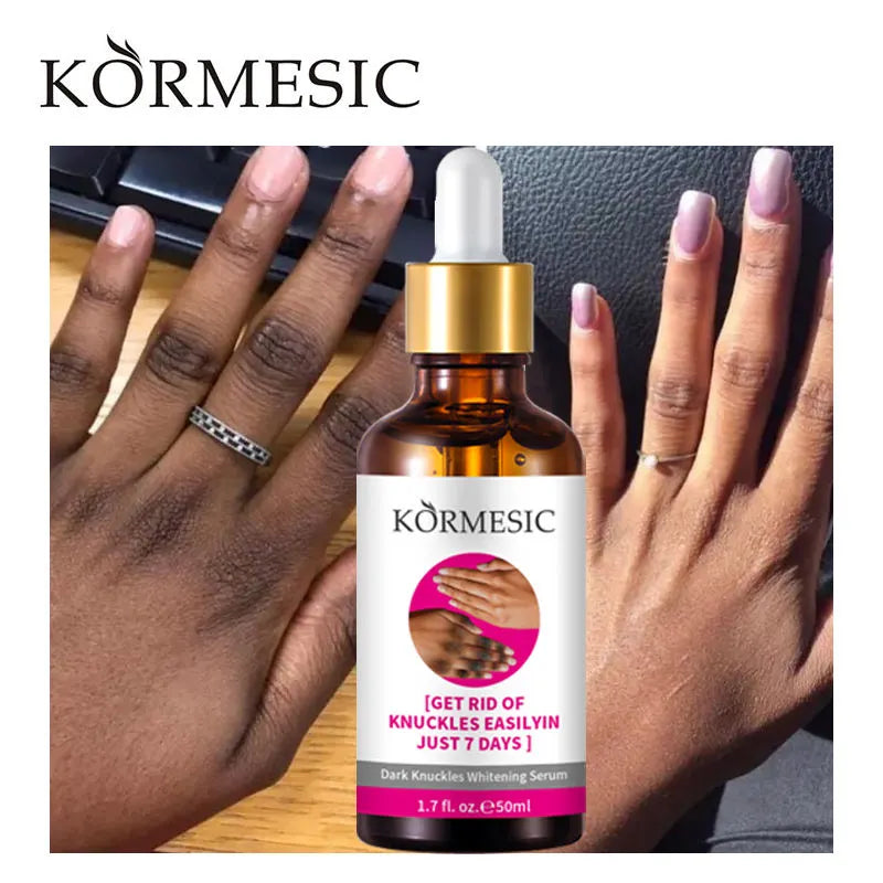 🔥SERUM BLANQUEADOR KORMESIC LUMINOUS TOUCH🧬