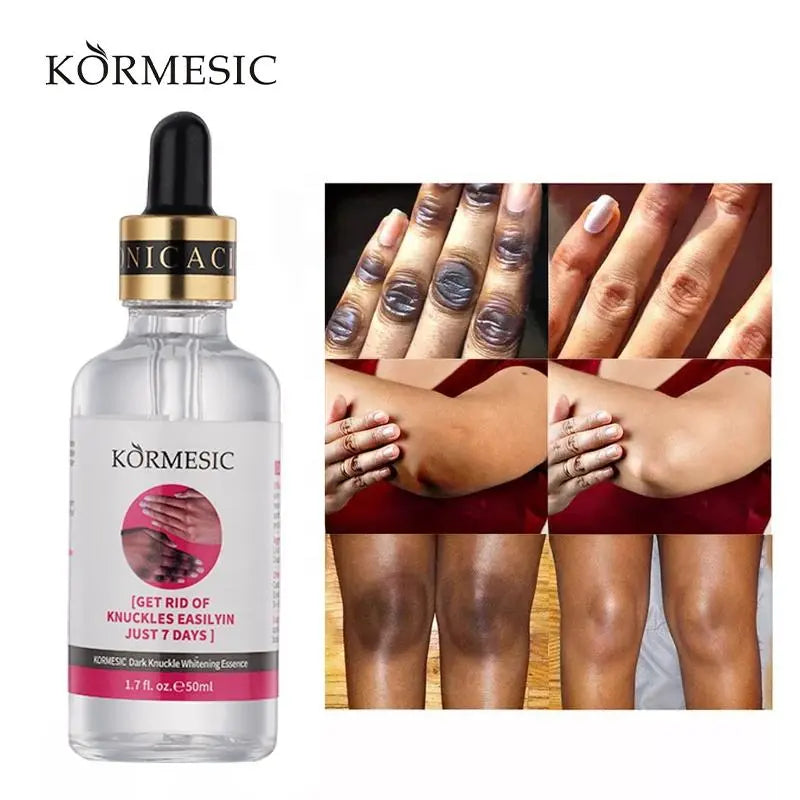 🔥SERUM BLANQUEADOR KORMESIC LUMINOUS TOUCH🧬